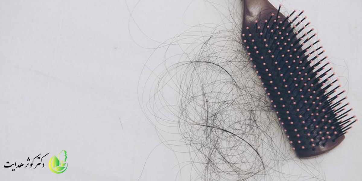 ریزش مو بعد از بیماری کووید