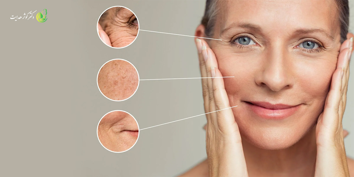 بهترین سن برای شروع بوتاکس یا درمانهای ضدچروک