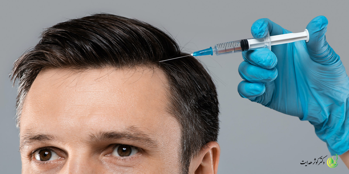 مزوتراپی سر