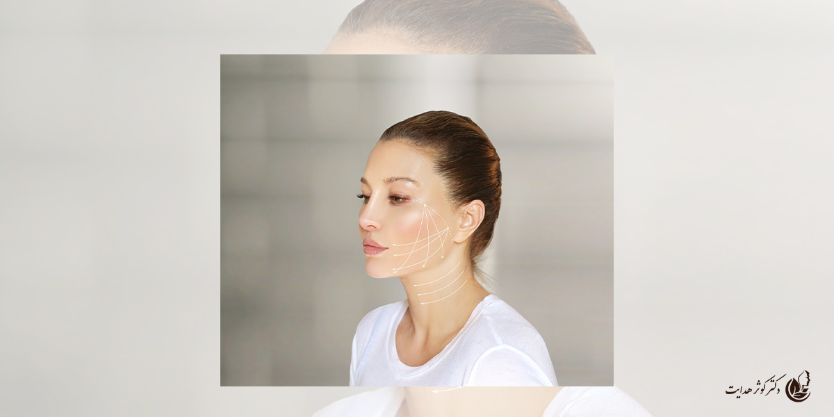 لیفت نخ سیلوئت؛ انقلابی در جوان سازی پوست