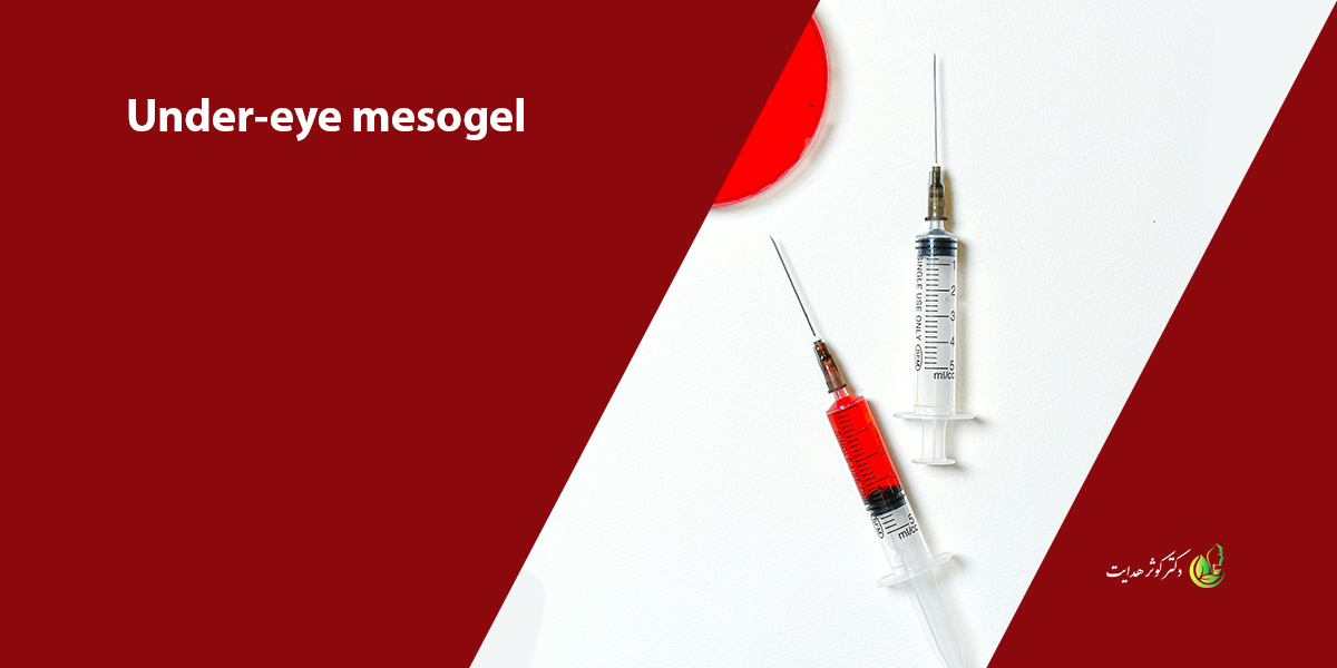 جوانسازی و درمان چروک زیر چشم با مزوژل