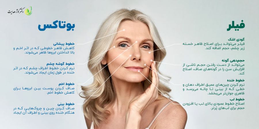فرق بوتاکس و فیلر چیست و چه زمانی باید استفاده شوند؟