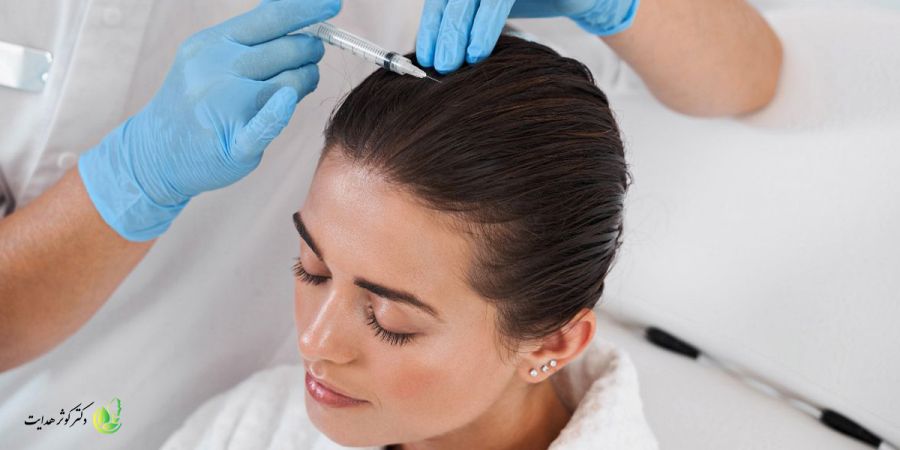 مزوتراپی سر