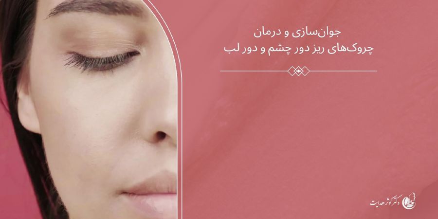 جوانسازی دور چشم