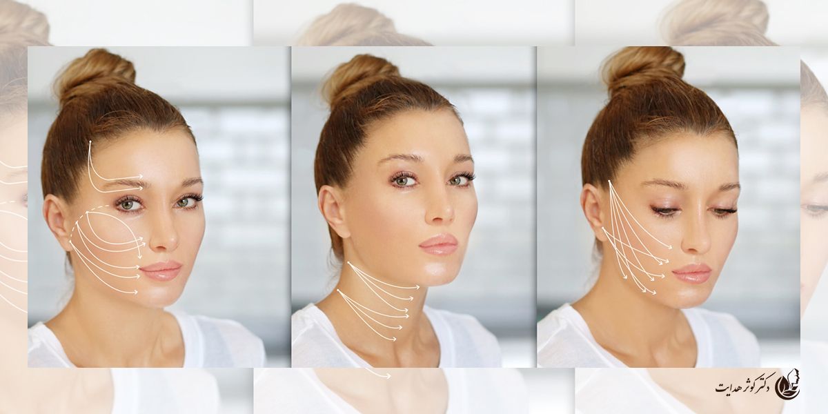 لیفت نخ سیلوئت؛ انقلابی در جوان‌سازی پوست