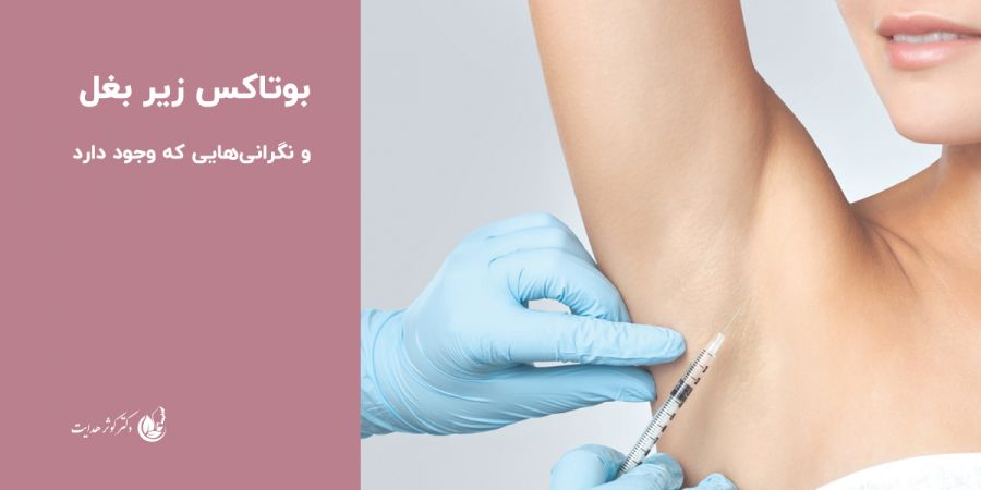 بوتاکس زیر بغل و نگرانی‌هایی که وجود دارد